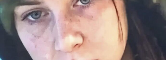 Ραγδαία εξέλιξη με την Λόρα – Ζήτησαν DNA από την μητέρα της