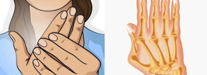 Ρευματοειδής αρθρίτιδα: Τα συνήθη συμπτώματα- Τι να τρώτε και τι να αποφεύγετε