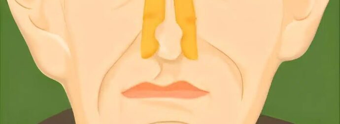 Να γιατί υπάρχει η λεγόμενη «γεροντίλα» και πως αντιμετωπίζεται