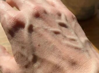 Ο χάρτης της ανθρώπινης κυκλοφορίας και οι βιολογικοί παράγοντες που διαμορφώνουν την ορατότητα του αγγειακού δικτύου