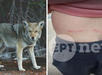 ΘΡΙΛΕΡ ΣΤΟ ΤΑΤΟΪ: ΑΙΜΑΤΗΡΗ ΕΠΙΘΕΣΗ ΛΥΚΟΥ ΣΕ ΠΕΡΙΠΑΤΗΤΗ – ΕΙΚΟΝΕΣ ΠΟΥ ΣΟΚΑΡΟΥΝ