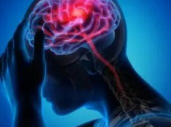 Εγκεφαλικό: Το πιο επικίνδυνο ποτό που αυξάνει τον κίνδυνο