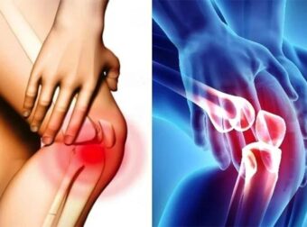 Σας πονάνε τα γόνατα; Οι επιστήμονες… μίλησαν αυτά είναι τα καλύτερα παπούτσια για όσους έχουν πρόβλημα και ποια απαγορεύονται αυστηρά