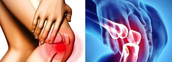 Σας πονάνε τα γόνατα; Οι επιστήμονες… μίλησαν αυτά είναι τα καλύτερα παπούτσια για όσους έχουν πρόβλημα και ποια απαγορεύονται αυστηρά