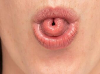 Τι σημαίνει ψυχολογικά η ικανότητα να διπλώνεις τη γλώσσα σου σε σχήμα «U»