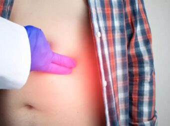 Σημάδια καρκίνου του παχέος εντέρου: Τα συμπτώματα που δεν πρέπει να αγνοήσετε