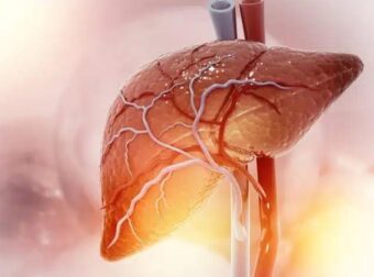 Λίπος στο συκώτι: Τι να τρώτε για να το μειώσετε χωρίς φάρμακα – Τροφές που πρέπει να αποφεύγετε