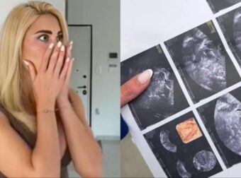 «Καλέ είσαι έγκυος;»: Η Ιωάννα Τούνη, ανέβασε τον υπέρηχο σε βίντεο και όλες είδαν αυτό που «μάλλον» ήθελε να κρύψει…