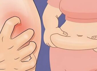 Σάκχαρο: 14 προειδοποιητικά σημάδια ότι μπορεί να έχει αυξηθεί και δεν πρέπει να αγνοήσετε