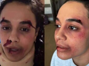 «Ποιος σου το έκανε αυτό;»: Ουρλιαχτά και κλάματα για την ηθοποιό Πηνελόπη Πλάκα