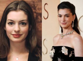 Αν Χάθαγουεϊ: Πώς η σταρ δείχνει νεότερη στα 43 από ό,τι στα 20 της – Ειδικός αποκαλύπτει τα μυστικά πίσω από τη λάμψη της