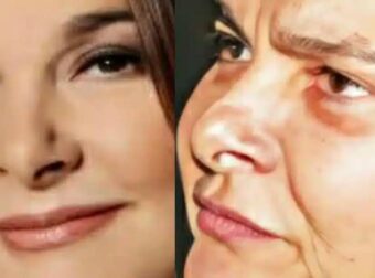 Αγνώριστη σήμερα στα 65 η πασίγνωστη τραγουδίστρια μεγάλων επιτυχιών Κατερίνα Κούκα