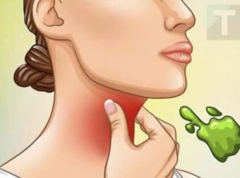 ΟΙ ΠΡΑΓΜΑΤΙΚΕΣ ΑΙΤΙΕΣ ΤΗΣ ΒΛΕΝΝΑΣ ΣΤΟ ΛΑΙΜΟ