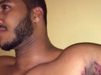 Εκεί που έκανε μπάνιο, ένιωσε κάτι να τον καίει κάτω από τη μασχάλη. Δεν ήταν όμως το σαπούνι…