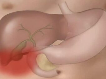 Το «φάpμακο του φτωχού»: Η πάμφθηνη τροφή για ένα Υγιές έντερο