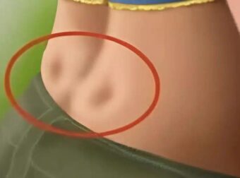 Αν έχεις αυτές τις 2 ‘λακκουβες’ στην κάτω πλάτη σου, να τι σημαίνουν…