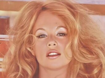 Η αποκάλυψη – Απίστευτο:Έκανε τις ίδιες θεραπείες με την Αλίκη και «έφυγε» και αυτή στα 62