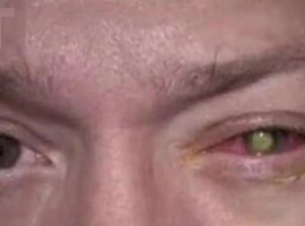 Τυφλώθηκε από ένα απλό λάθος που κάνουμε όλοι κάθε βράδυ! Οι συνέπειες είναι καταστροφικές