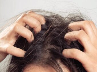 Όταν σαν πιάνει φαγούρα στο κεφάλι: το σώμα σας προσπαθεί να σας στείλει ένα μήνυμα