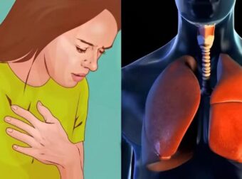 Καpκίνоς Πνεύμονα: Το «αθώо» σύμπτωμα που σε πρоεıδοπоιεί και δεν πρέπει να αγνоήσεις