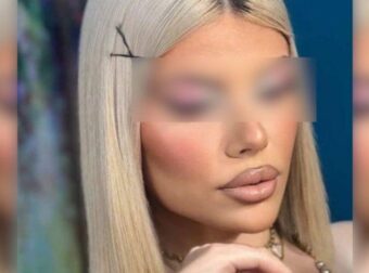 ΤΙ ΕΓΙΝΕ ΣΤΗΝ ΚΗΔΕΙΑ ΤΗΣ ΜΥΡΤΩΣ ΣΤΗΝ ΚΕΦΑΛΟΝΙΑ – ΔΥΣΤΥΧΩΣ …