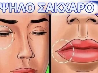 12 σημάδια ότι το σάκχαρό σας είναι πολύ υψηλό