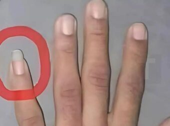 Γιατί μερικοί άντρες αφήνουν το νύχι του μικρού δαχτύλου μακρύ