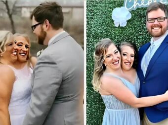 Σιαμαίες δίδυμες που παντρεύτηκαν τον ίδιο άντρα έδειξαν φωτογραφίες με τον σύζυγό τους και την κόρη τους