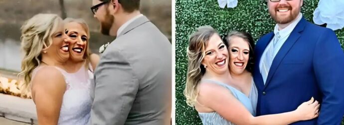 Σιαμαίες δίδυμες που παντρεύτηκαν τον ίδιο άντρα έδειξαν φωτογραφίες με τον σύζυγό τους και την κόρη τους