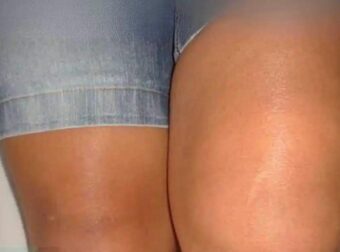 Αν δείτε το ένα πόδι πρησμένο τότε είναι σημάδι ότι…