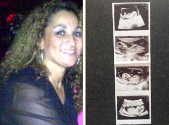 50χpονη γιαγιά ένιωθε αδιαθεσiα για καιpό: Μόλις πήγε στον γυναικολόγο τα έχασε με αυτό που της ανακοiνωσε