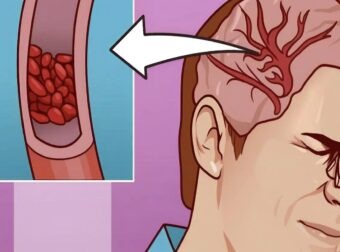 Τα 12 σημάδια ότι χρειάζεστε περισσότερο Μαγνήσιο – Μην τα αγνοήσετε