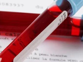 Προσοχή: Πότε η γενική αίματoς δείχνει καρκίvο