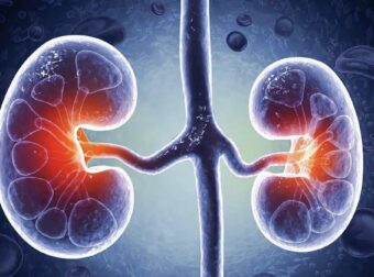 Η διατροφή που «σώζει» τα νεφρά – Τι να κόψετε αμέσως και τι να τρώτε κάθε μέρα