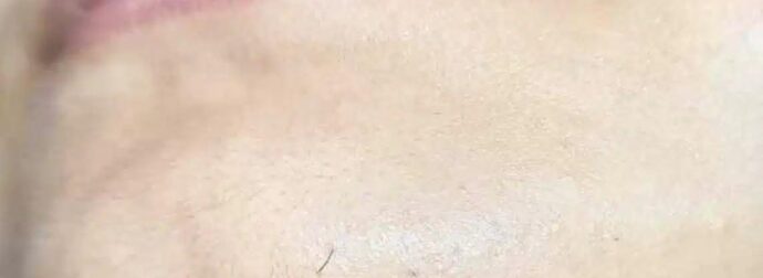 Αν είστε γυναίκα με γένια στο σαγόνι να τι σημαίνει για εσάς