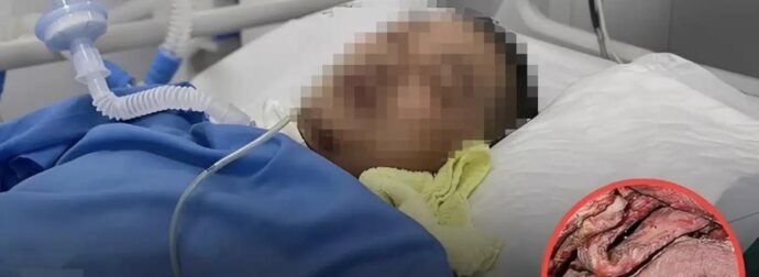 Γιατί η κατανάλωση περισσότερου από αυτό το κρέας μπορεί να σας βάζει σε κίνδυνο