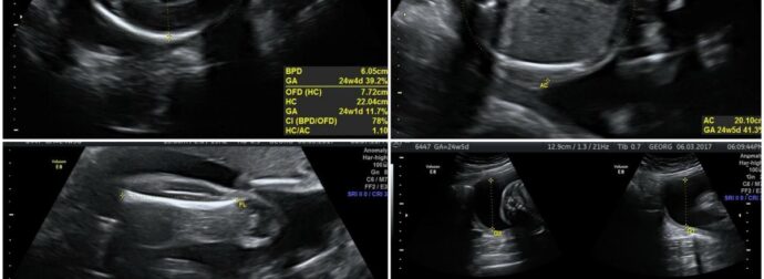 Ζευγάρι πήγε για ένα συνηθισμένο υπερηχογράφημα: Η στιγμή που ο σύζυγος δεν άντεξε την αποκάλυψη