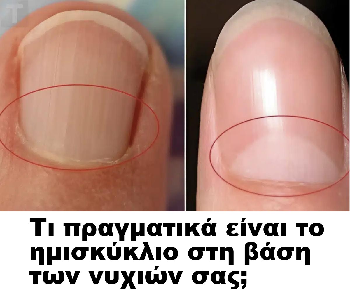 Τι πραγματικά είναι το ημισκύκλιο στη βάση των νυχιών σας;