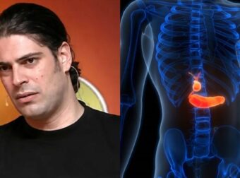 Με αφορμή τον θάνατο του Λορέντζο Καριέρε: Οι 7 ύπουλες ενδείξεις του καρκίνου στο πάγκρεας που πολλοί αγνοούν