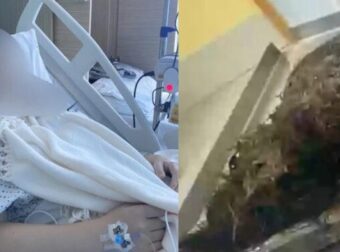 ΣΟΚ: Νόμιζαν ότι ήταν δυσανεξία στη γλουτένη – Αυτό που βρήκαν οι γιατροί στο στομάχι της 14χρονης δεν το πίστευε κανείς