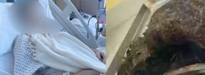 ΣΟΚ: Νόμιζαν ότι ήταν δυσανεξία στη γλουτένη – Αυτό που βρήκαν οι γιατροί στο στομάχι της 14χρονης δεν το πίστευε κανείς
